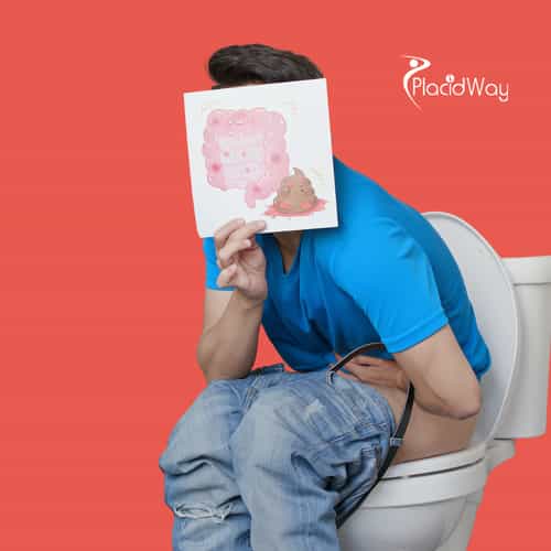 Cáncer colorrectal en México: Cómo las inmunoterapias y las opciones alternativas están cambiando vidas